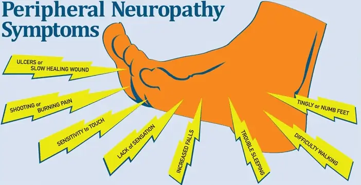 New Advancements in Peripheral Neuropathy Treatment