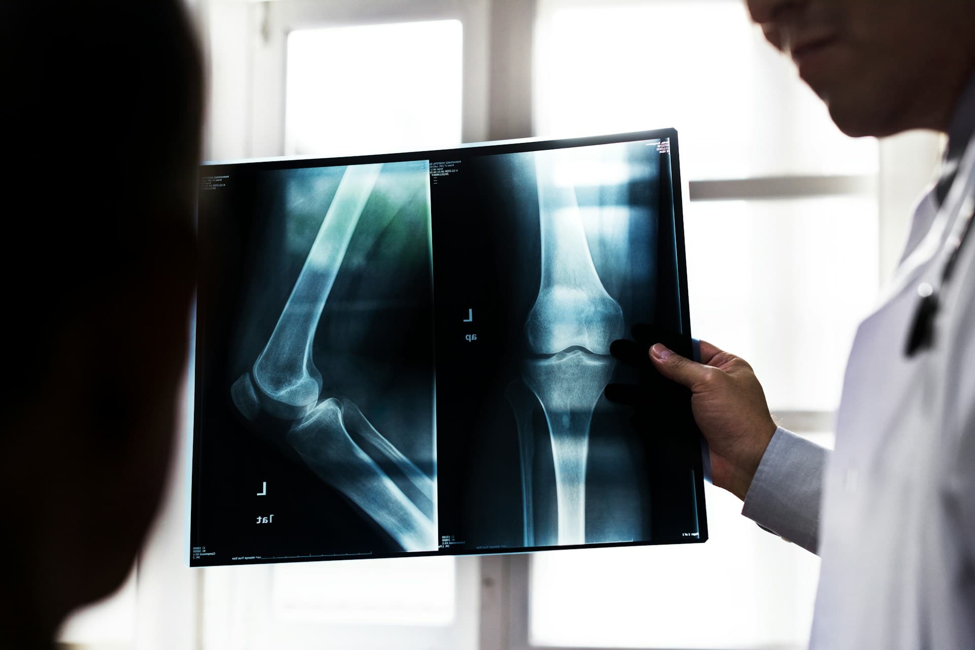 Questioning Knee Surgery? Non-Surgical Back Pain Treatment Links You May Miss