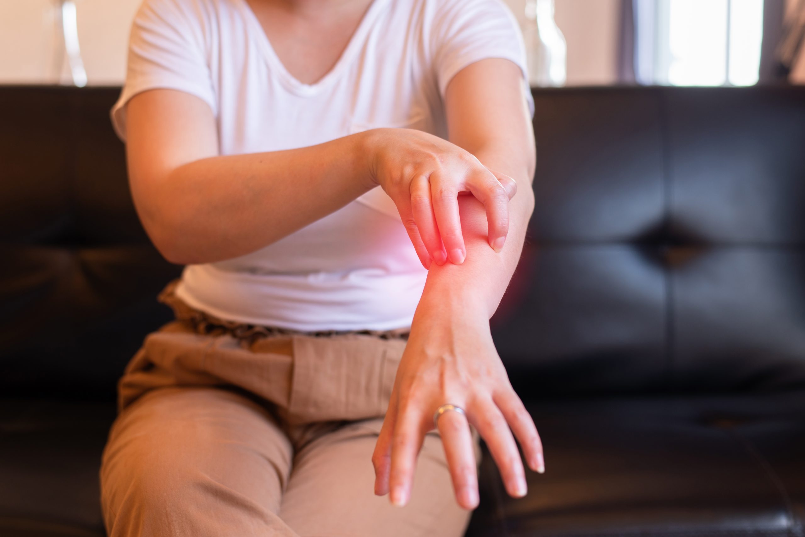 Woman with rash or papule and scratch on her arm