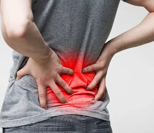 Sciatica