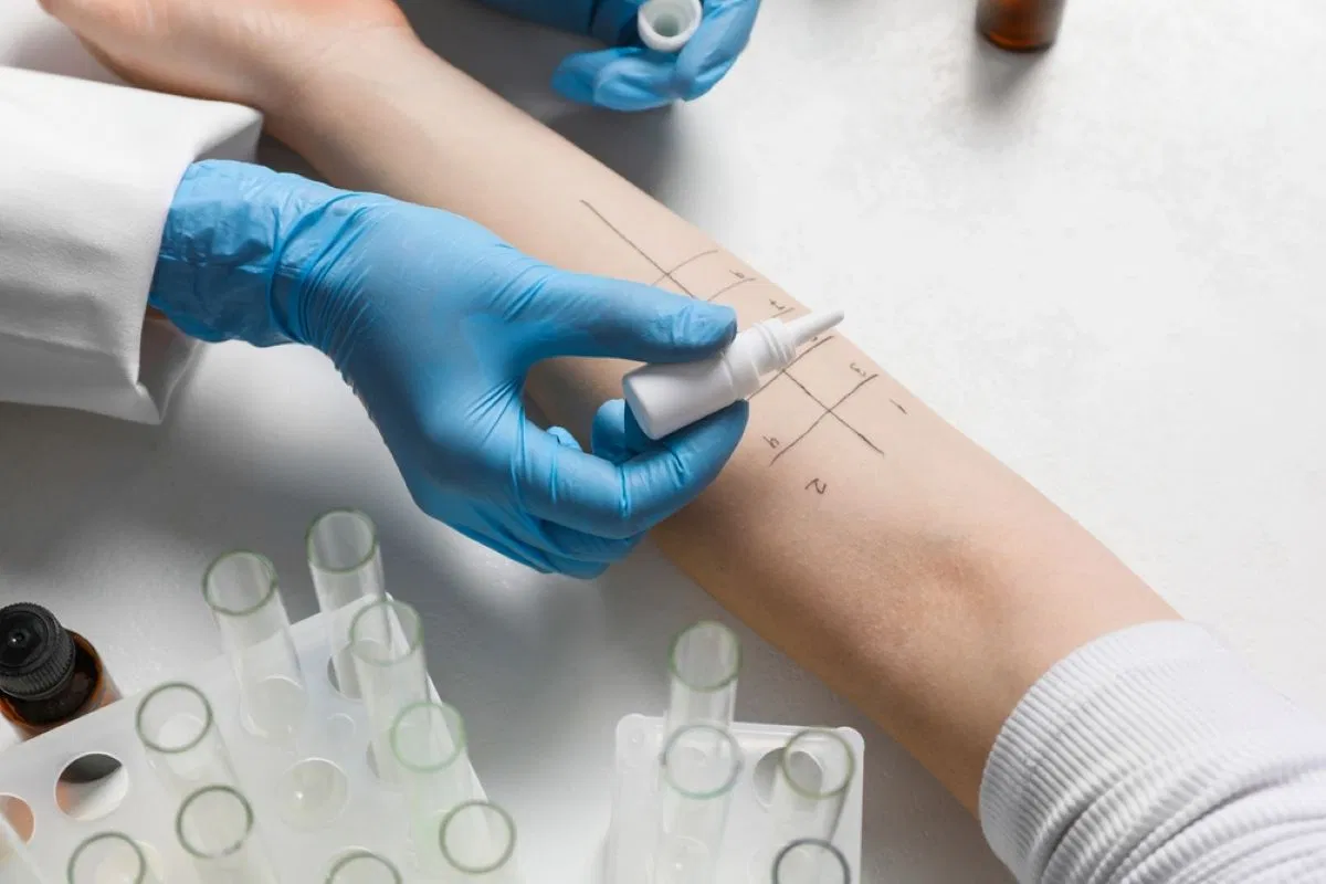 Allergy testing