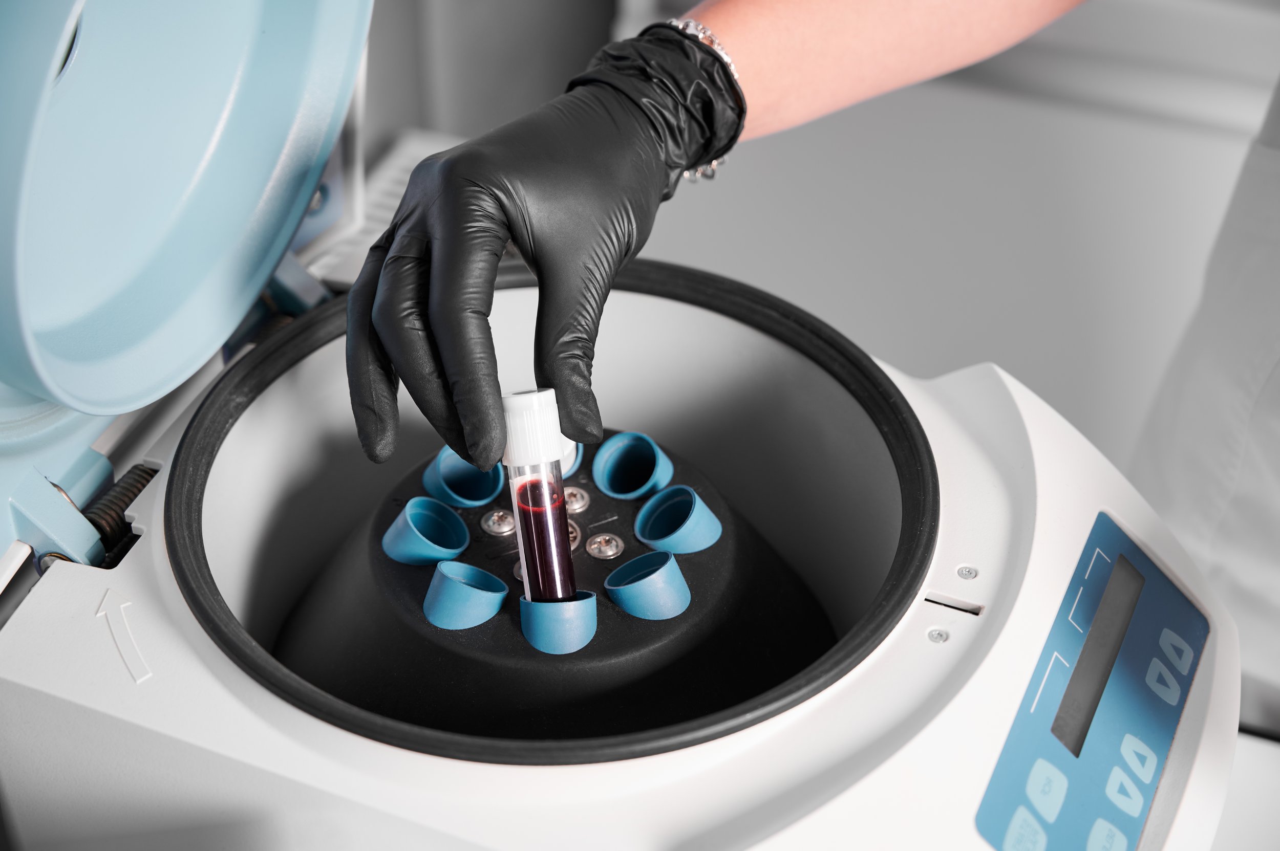 Preparation of PRP blood injection with vial of blood in centrifuge